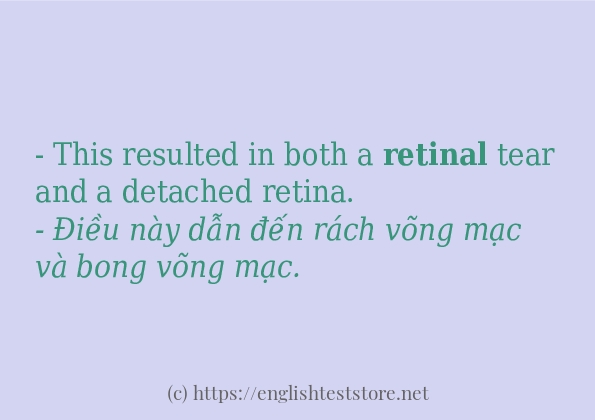 Các câu ví dụ của từ retinal Các câu ví dụ của từ retinal