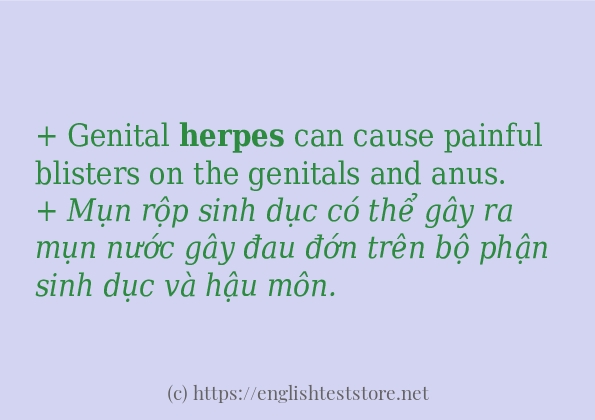 Các câu ví dụ và cách dùng từ herpes