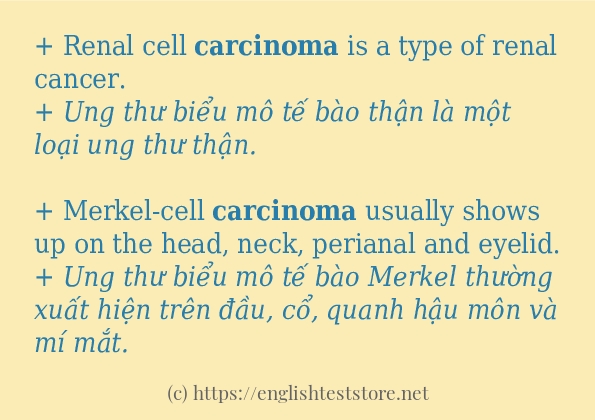 carcinoma sử dụng như thế nào và câu ví dụ