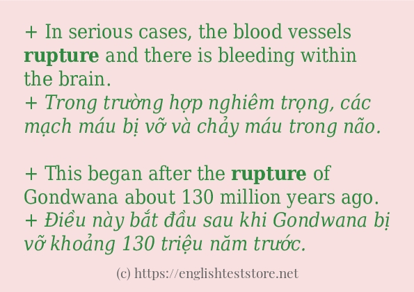 rupture các ví dụ và câu điển hình