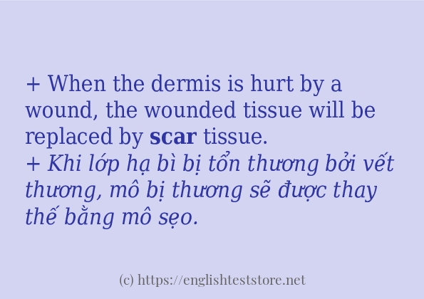 scar cách dùng và câu ví dụ scar cách dùng và câu ví dụ