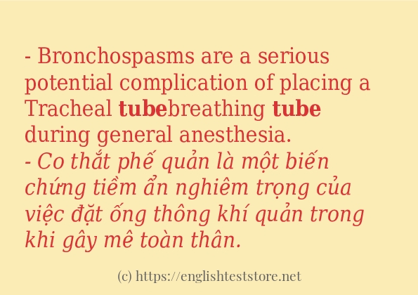 tube các ví dụ và câu điển hình